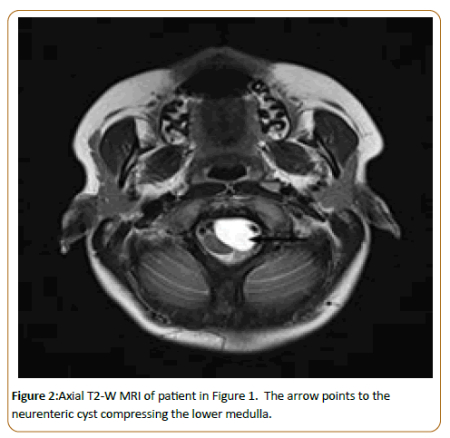 pediatric-care-axial