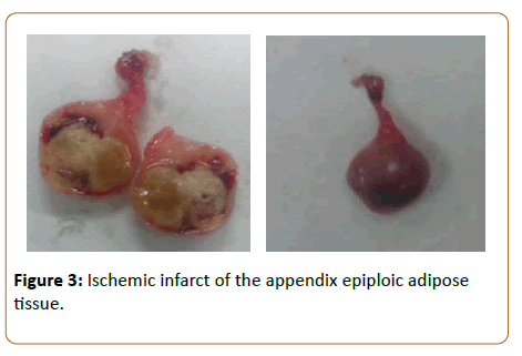 pediatric-care-ischemic