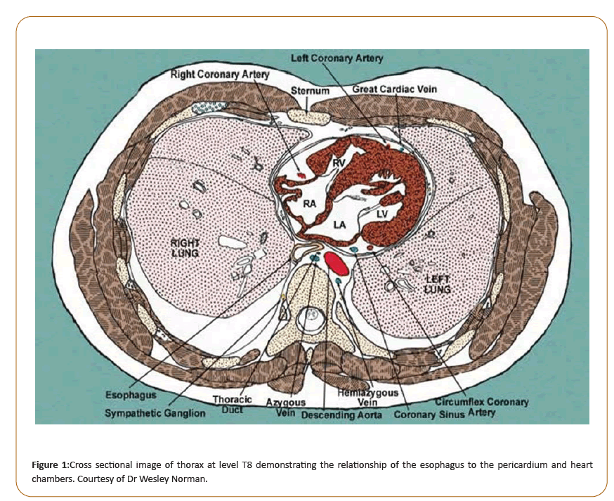 pediatric-care-thorax