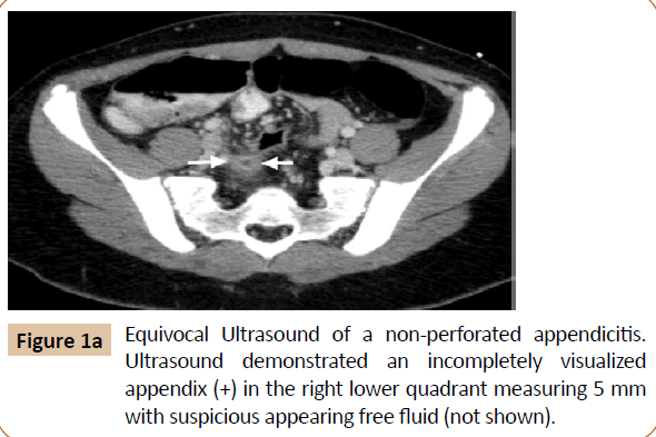 pediatrics-Equivocal-Ultrasound