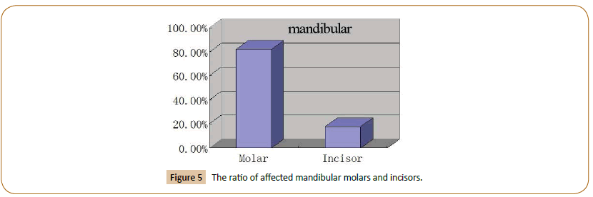 pediatrics-affected-mandibular-molars-incisors