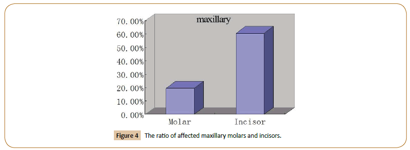 pediatrics-affected-maxillary-molars-incisors